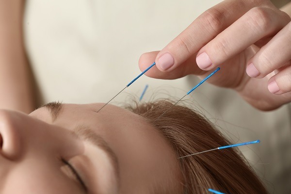 Acupuncture treats post-COVID conditions overseas