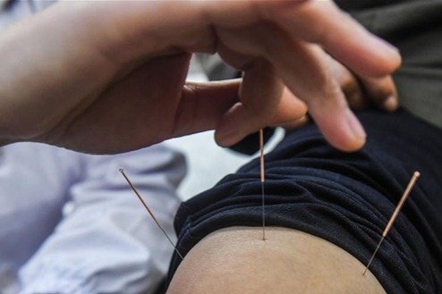 ​Acupuncture and moxibustion