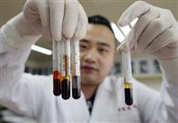 China to set exclusive standard for domestic children's blood test indicators