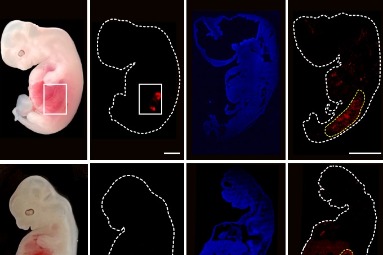 Scientists grow human kidneys in pig embryos