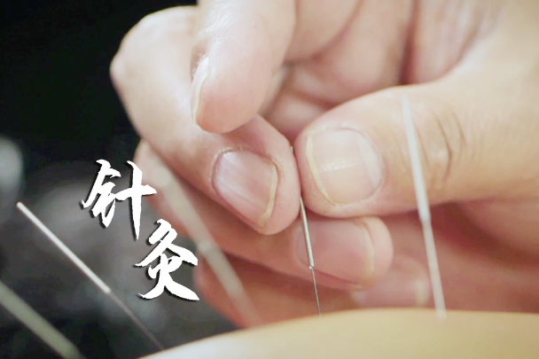 Living Heritage: Acupuncture