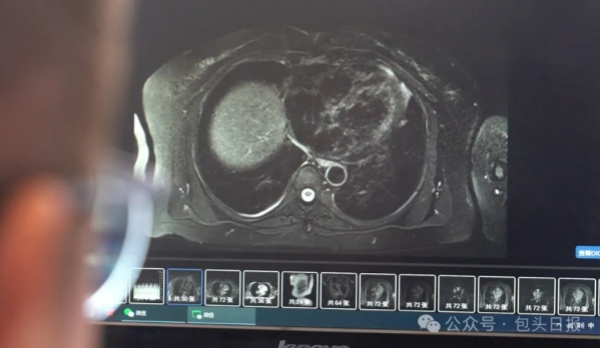 Baotou enhances medical test result sharing for better patient care