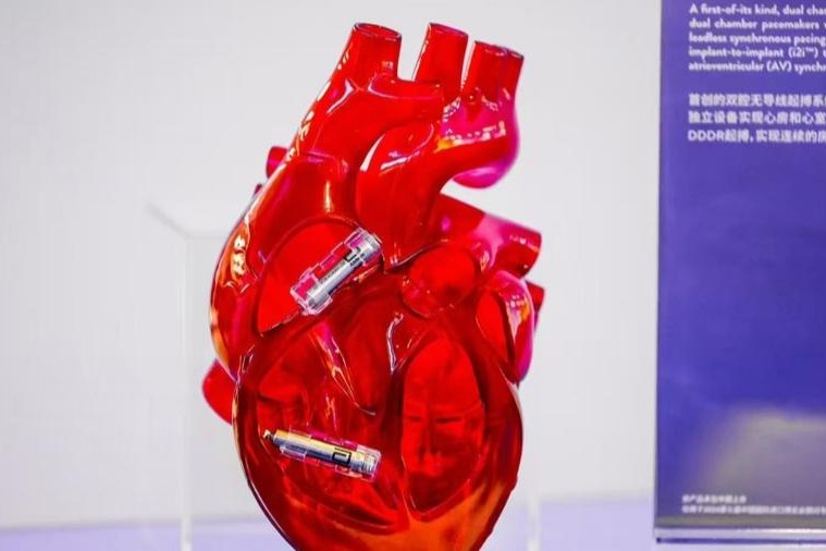 World's 1st dual chamber leadless pacemaker begins clinical use in China