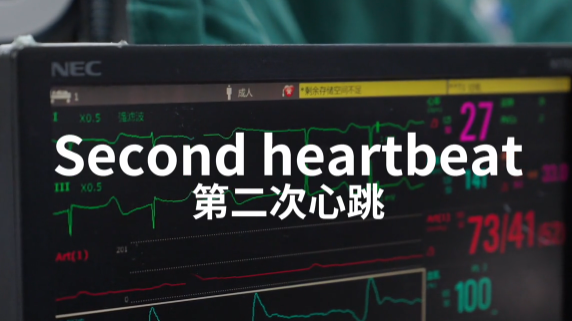 Second heartbeat